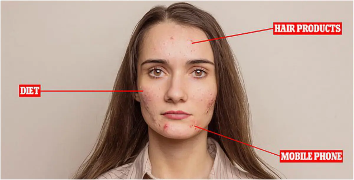 لماذا تتضرّر البشرة بمناطق مُتعددة من الوجه؟.. وما هو العلاج؟