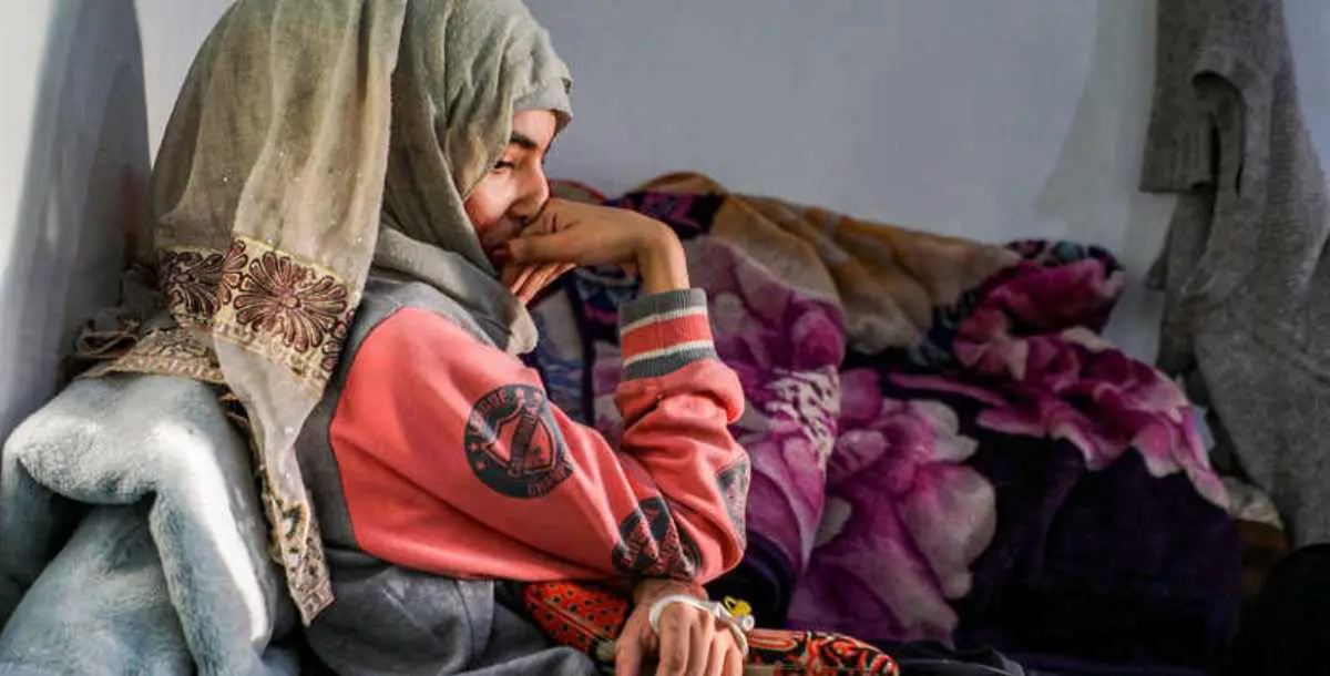 العنود.. شابة يمنية تزوجت بعمر الـ12 وتعرضت للعنف والحرق بالأسيد