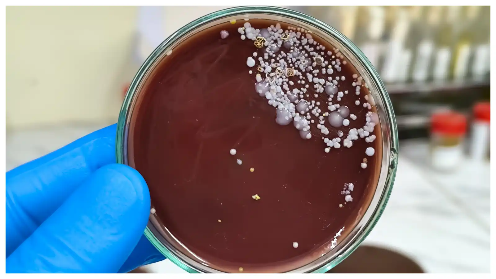 candida auris