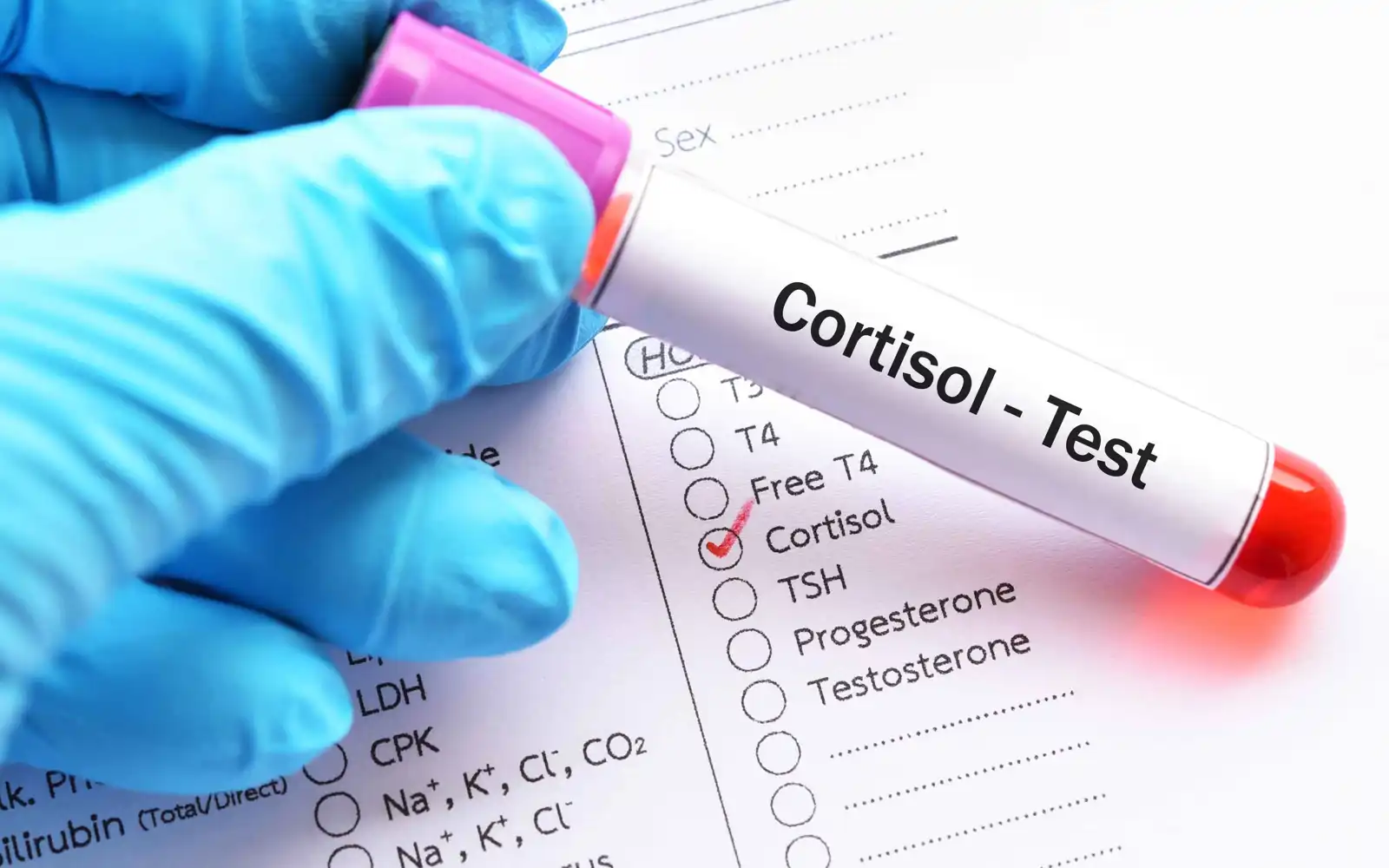 فحص الكورتيزول