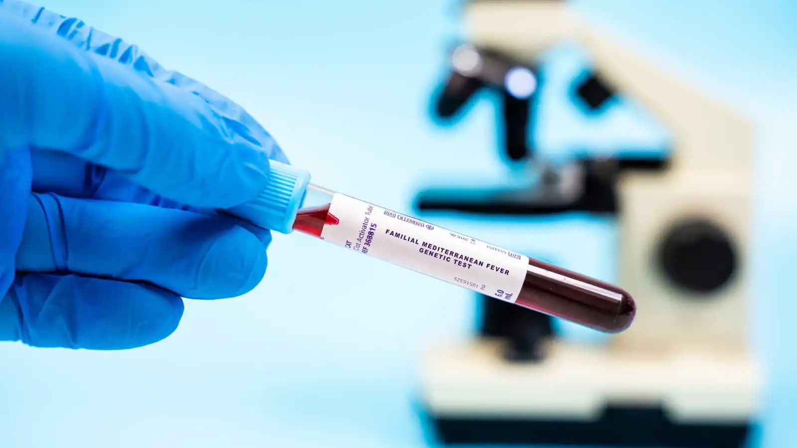 ما حمى البحر المتوسط التي يعاني منها باسل خياط؟ الأسباب والأعراض