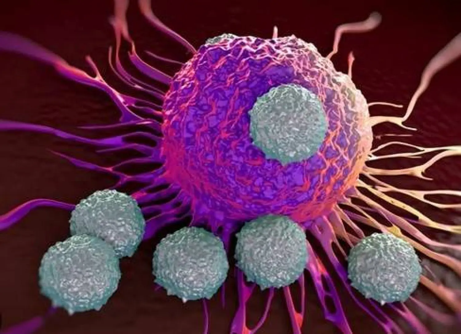 تعبيرية