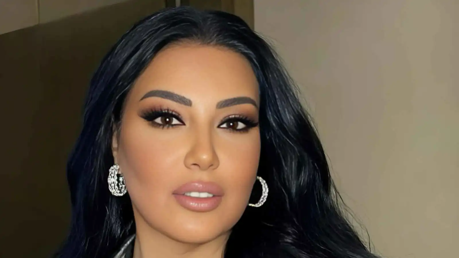 سمية الخشاب تطالب بمعاقبة مُعذّبي الحيوانات