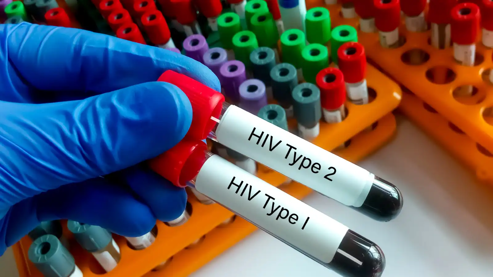 دواء جديد لعلاج فيروس نقص المناعة البشرية HIV-1 يحقق نتائج واعدة
