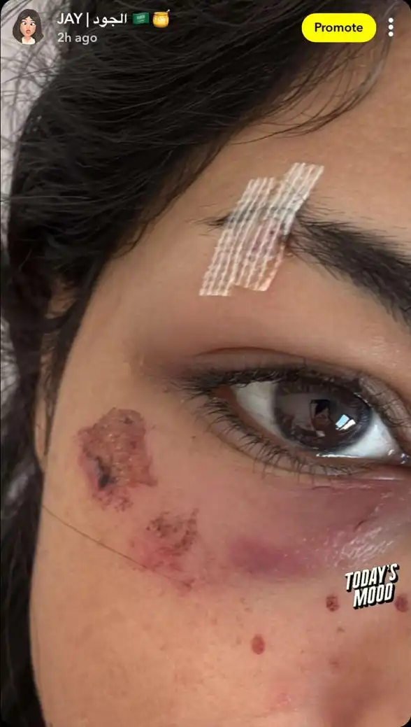 جود السفياني تطمئن جمهورها بعد مغادرة المستشفى