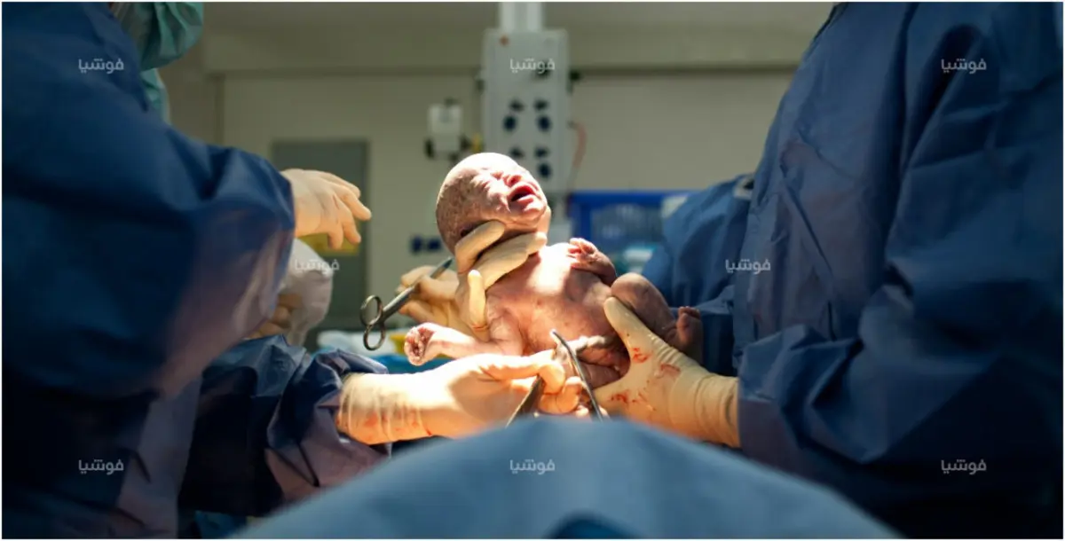 الأطباء يهربون خلال ولادة امرأة عراقية.. ويتركون جرحها مفتوحا!