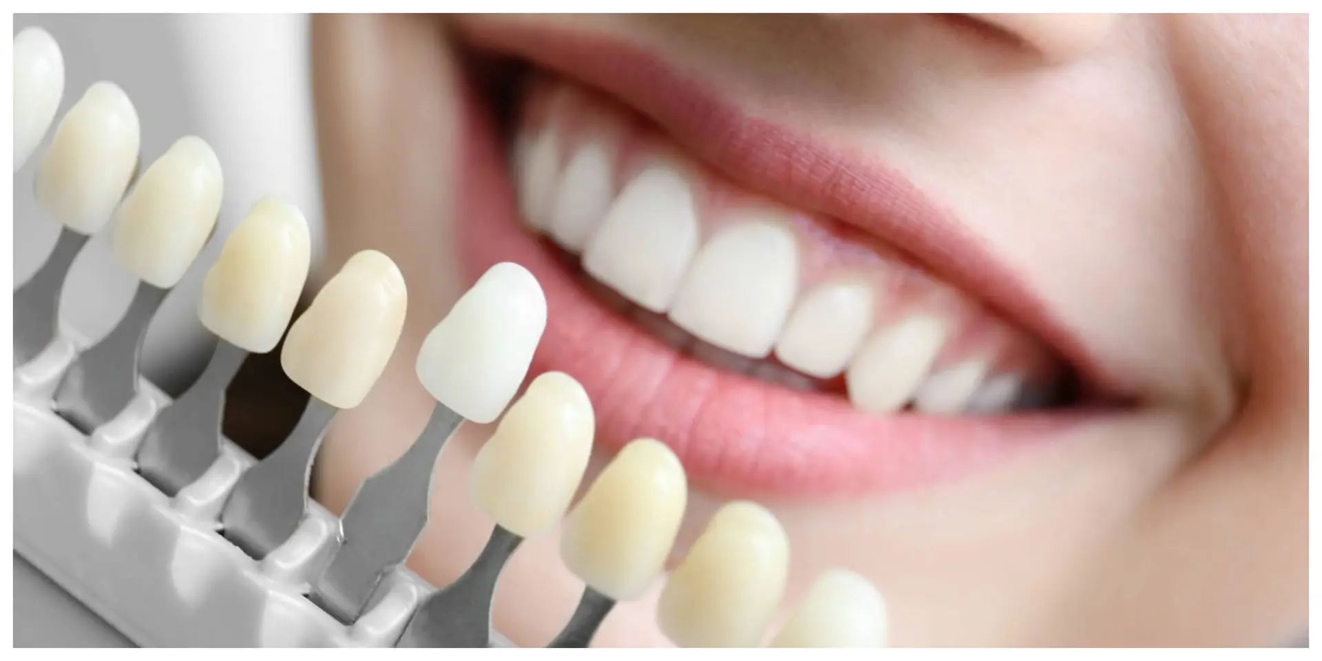 هذه المادة الكيميائية الجديدة تبيّض الأسنان دون الإضرار بطبقة المينا!