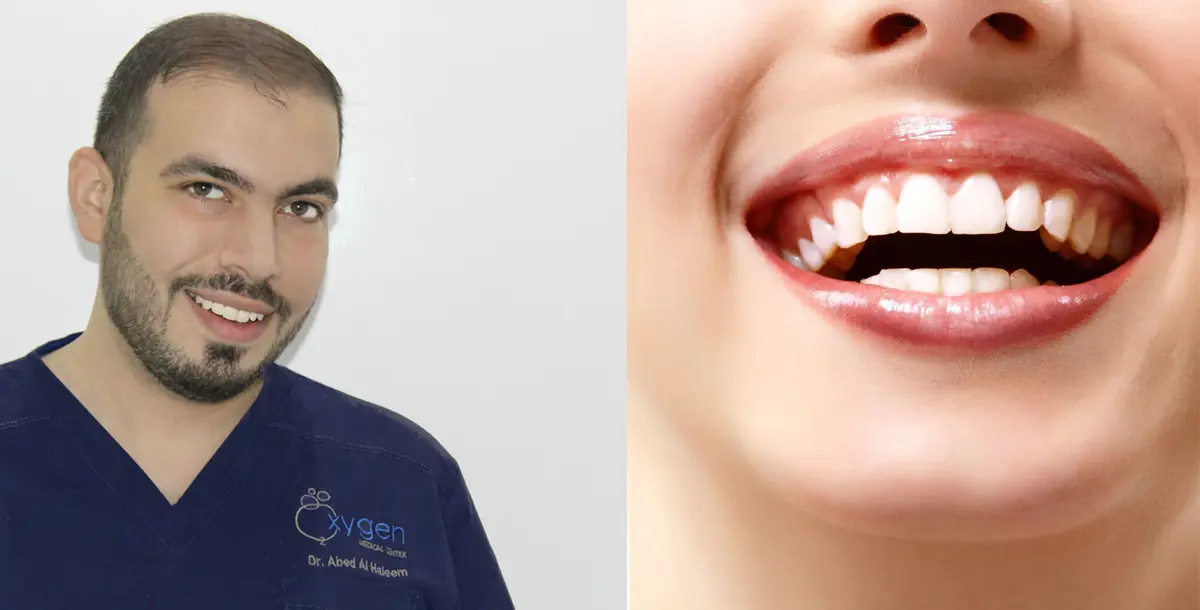 الدكتور عبد الحليم المرداوي يجيب "فوشيا" عن الأسئلة الشائعة حول تبييض الأسنان