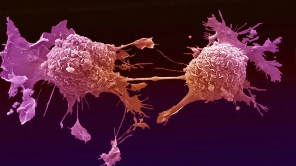 هل يمكن اكتشاف السرطان قبل تشخيصه بـ7 سنوات؟
