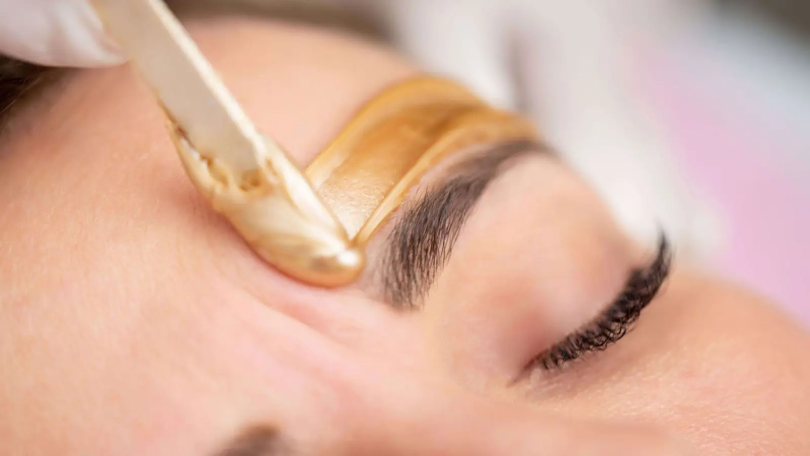 إزالة الشعر