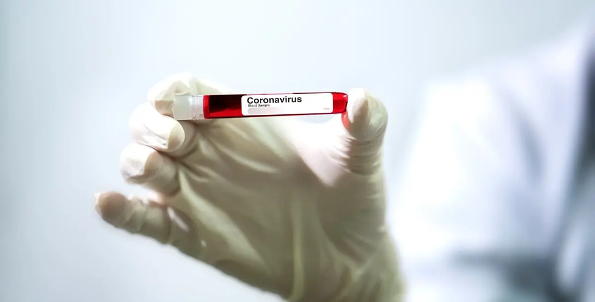 هل يمكن أن تؤدي الإصابة بفيروس كورونا إلى تلف الكلى؟