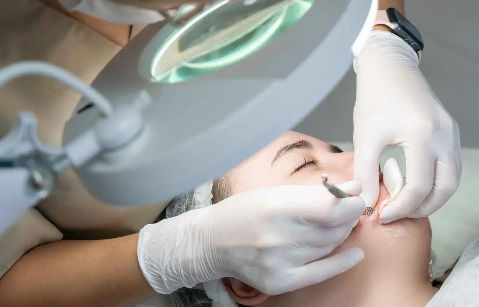 تقنية Dermaplaning