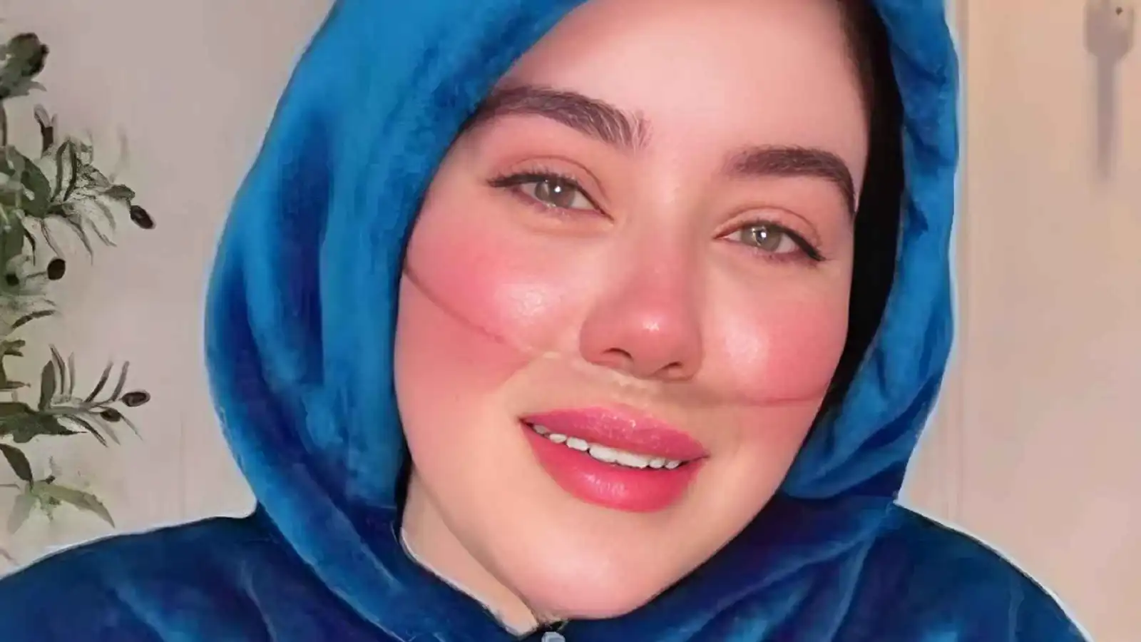 تفاصيل اتهام البلوغر دنيا فؤاد باستغلال مرض السرطان