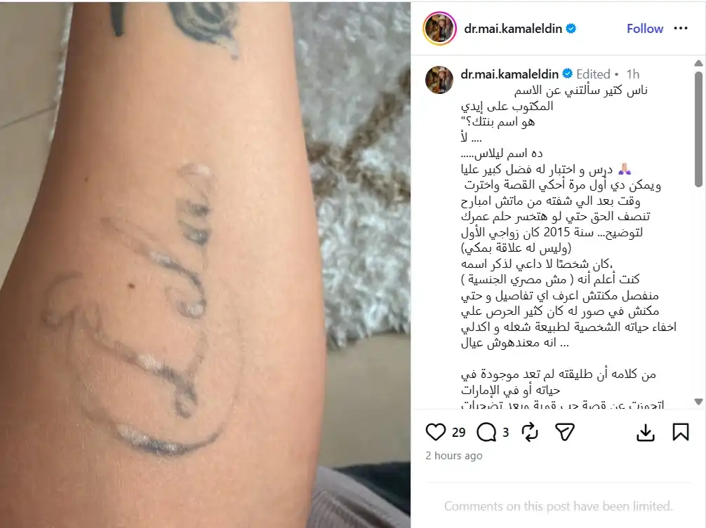 لماذا يحمل ذراع مي كمال الدين اسم "ليلاس"؟