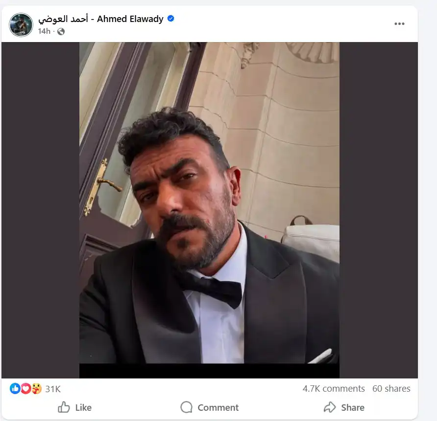 أحمد العوضي ببدلة الزفاف