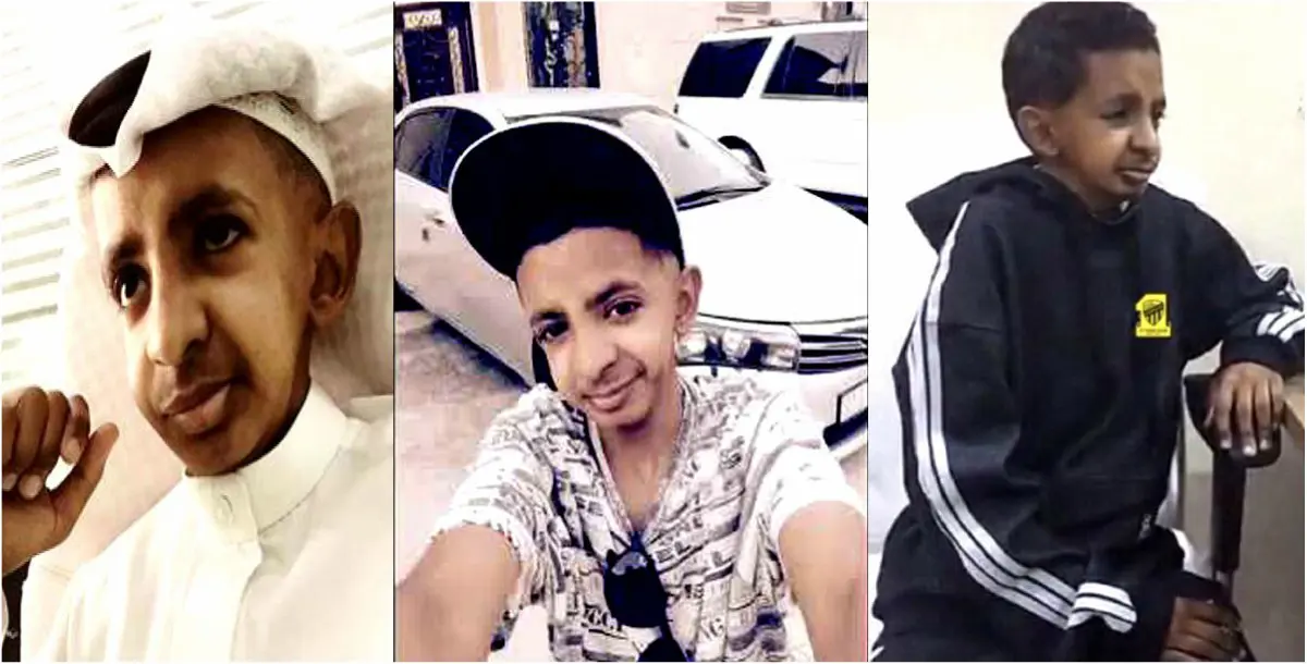 عبد الرحمن الشهراني: حاولت الانتحار بسبب التنمر.. والسرطان وراء شكل فمي وأسناني!