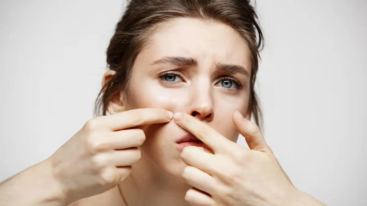 أنواع الرؤوس البيضاء