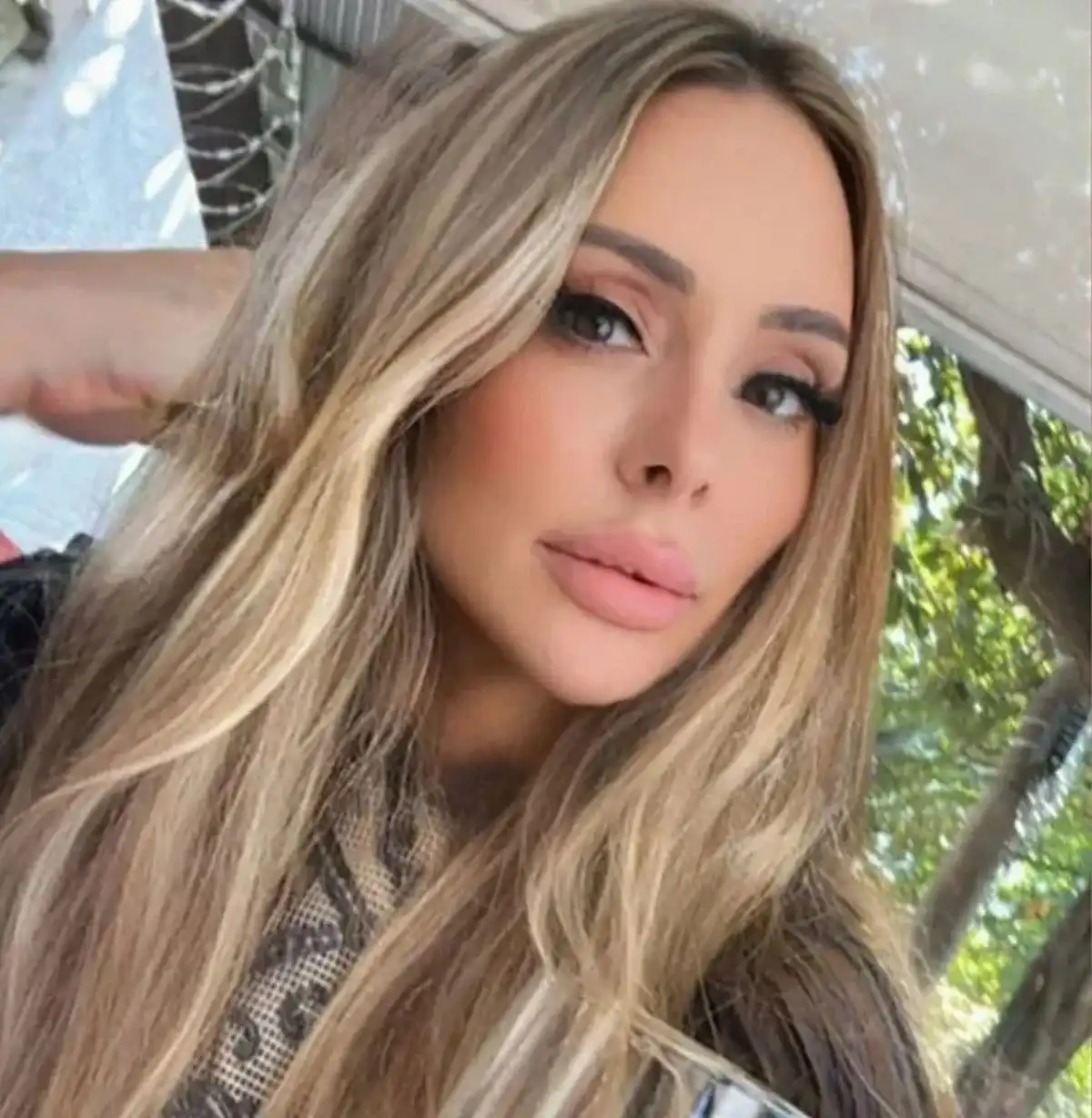 وفاة أندريا فييرا غاسبار بعد جراحة استمرت 8 ساعات وشملت 6 إجراءات تجميلية