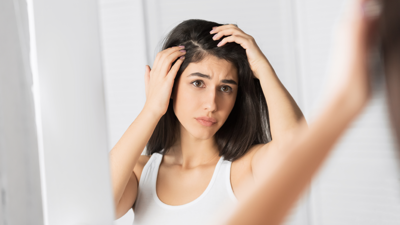علاج قشرة الرأس نهائيًا بوصفات منزلية طبيعية