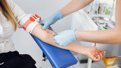 ما علاقة تحليل الدم بطريقة علاج أمراض الشيخوخة؟