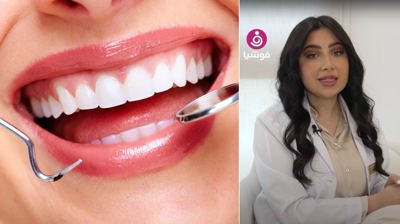 الدكتورة رسل ياسين: اللون الأبيض ليس قاعدة لتجميل الأسنان