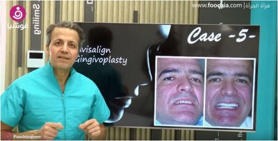 كيف تبدين أصغر من عمرك الحقيقي من خلال أسنانك؟
