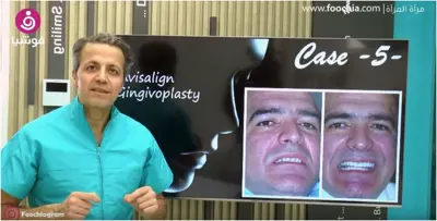 كيف تبدين أصغر من عمرك الحقيقي من خلال أسنانك؟