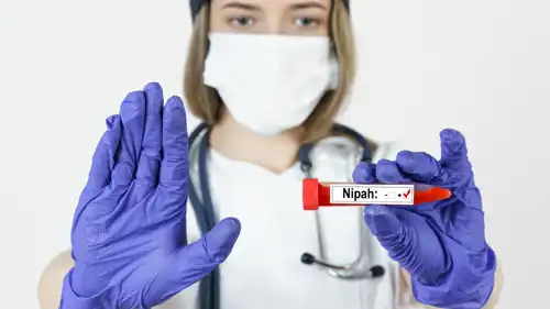 فيروس نيباه