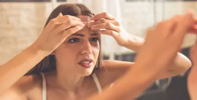 ما هو المكوّن الفعّال لعلاج البثور بحسب أنواعها؟